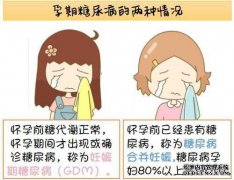 怀孕期间我是否需要进行糖筛查？什么是预防措