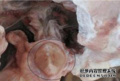 这名男子自杀身亡。他看着他的肚子，看到了他