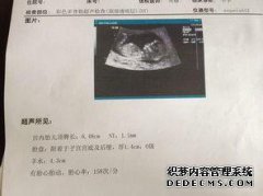 [b super nt的正常值是多少？NT值多少？]
