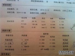 47xn18的儿童可能接受羊膜穿刺术吗？