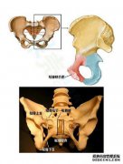 引入分离耻骨键？什么是耻骨分离疾病？