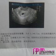 [药流后你能背诵吗？]